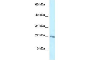 WB Suggested Anti-RPL23A Antibody Titration: 1.
