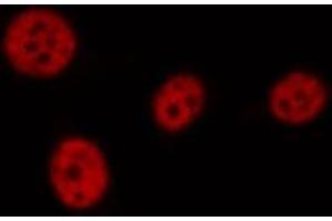 ABIN6276926 staining HT29 by IF/ICC. (LIG1 抗体  (Internal Region))