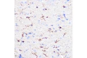 Immunohistochemistry (IHC) image for anti-Glial Fibrillary Acidic Protein (GFAP) (C-Term) antibody (ABIN3020751)