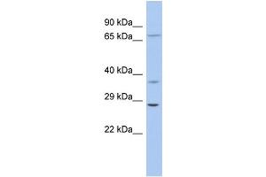 WB Suggested Anti-ASCL1 Antibody Titration: 0. (ASCL1 抗体  (Middle Region))