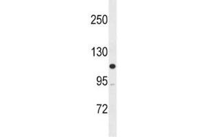 MLCK antibody western blot analysis in SK-BR-3 lysate (MYLK 抗体  (AA 908-938))