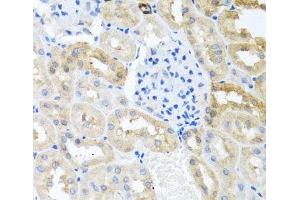 Immunohistochemistry of paraffin-embedded Rat kidney using MYLK Polyclonal Antibody at dilution of 1:100 (40x lens). (MYLK 抗体)