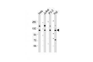 All lanes : Anti-REST Antibody (Center) at 1:2000 dilution Lane 1: Hela whole cell lysate Lane 2: Jurkat whole cell lysate Lane 3: PC-3 whole cell lysate Lane 4: Raji whole cell lysate Lysates/proteins at 20 μg per lane. (REST 抗体  (AA 542-570))