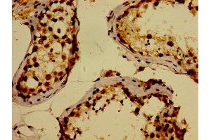 IHC image of ABIN7175871 diluted at 1:300 and staining in paraffin-embedded human testis tissue performed on a Leica BondTM system.