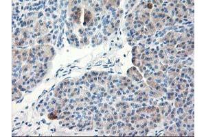 Immunohistochemical staining of paraffin-embedded Human pancreas tissue using anti-TBC1D21 mouse monoclonal antibody. (TBC1D21 抗体)