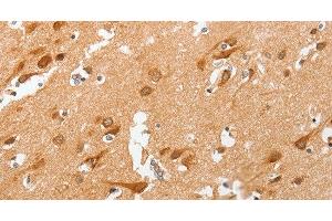 Immunohistochemistry of paraffin-embedded Human brain using cPLA2 Polyclonal Antibody at dilution of 1:50 (PLA2G4A 抗体)