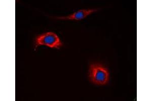 Immunofluorescent analysis of NPY2R staining in HeLa cells. (NPY2R 抗体  (N-Term))