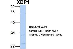Host: Rabbit Target Name: NOP56 Sample Type: MCF7 Antibody Dilution: 1. (XBP1 抗体  (C-Term))