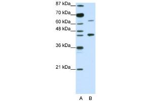 WB Suggested Anti-RARA Antibody Titration:  1. (Retinoic Acid Receptor alpha 抗体  (N-Term))