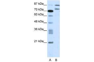 Western Blot showing ZNF709 antibody used at a concentration of 1-2 ug/ml to detect its target protein. (ZNF709 抗体  (N-Term))
