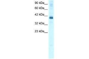 Human HepG2; WB Suggested Anti-TSC22D4 Antibody Titration: 0. (TSC22D4 抗体  (N-Term))