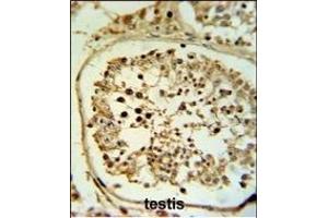 Immunohistochemistry (Paraffin-embedded Sections) (IHC (p)) image for anti-Fascin 3 (FSCN3) (AA 1-30), (N-Term) antibody (ABIN390722)