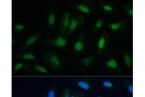 Immunofluorescence analysis of U-2 OS cells using ETS2 Polyclonal Antibody at dilution of 1:100. (ETS2 抗体)