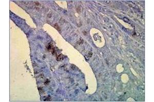 Immunohistochemistry (IHC) image for anti-Heat Shock Protein 70 (HSP70) antibody (ABIN263937) (HSP70 抗体)
