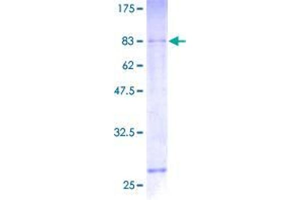 SRRT Protein (AA 1-429) (GST tag)