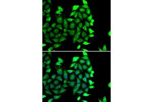 Immunofluorescence analysis of MCF-7 cells using IKZF3 antibody (ABIN6130489, ABIN6142290, ABIN6142291 and ABIN6223116).
