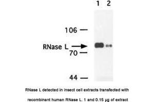 Image no. 1 for anti-Ribonuclease L (2',5'-Oligoisoadenylate Synthetase-Dependent) (RNASEL) antibody (ABIN363220) (RNASEL 抗体)