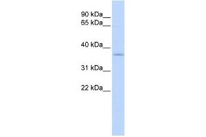 WB Suggested Anti-SFXN3 Antibody Titration:  0. (SFXN3 抗体  (Middle Region))