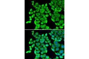 Immunofluorescence analysis of U20S cell using EEF1D antibody. (EEF1D 抗体  (AA 1-160))