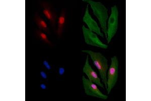 ABIN6261411 and ABIN6266531 staining  cells by IF/ICC. (E2F4 抗体  (N-Term))