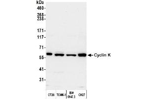 Western Blotting (WB) image for anti-Cyclin K (CCNK) (AA 530-580) antibody (ABIN7453581) (Cyclin K 抗体  (AA 530-580))