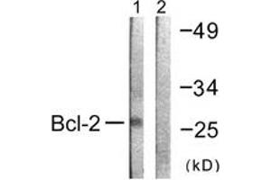Western blot analysis of extracts from K562 cells, using BCL-2 (Ab-69) Antibody. (Bcl-2 抗体  (AA 46-95))