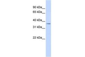Image no. 1 for anti-Tripartite Motif Containing 69 (TRIM69) (AA 36-85) antibody (ABIN6742519) (TRIM69 抗体  (AA 36-85))