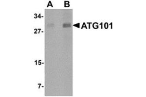 Western blot analysis of ATG101 in human liver tissue lysate with ATG101 antibody at (A) 1 and (B) 2 μg/ml. (ATG101 抗体  (Center))