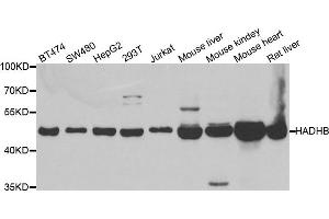 Western blot analysis of extracts of various cell lines, using HADHB antibody. (HADHB 抗体)