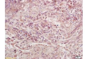 Immunohistochemistry (IHC) image for anti-Guanine Nucleotide Binding Protein (G Protein), alpha Activating Activity Polypeptide O (GNAO1) (AA 221-320) antibody (ABIN872799)