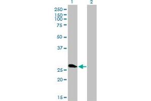 Western Blotting (WB) image for anti-Ring Finger Protein 114 (RNF114) (AA 1-229) antibody (ABIN466223) (RNF114 抗体  (AA 1-229))