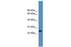 WB Suggested Anti-ZNF313  Antibody Titration: 0. (RNF114 抗体  (C-Term))