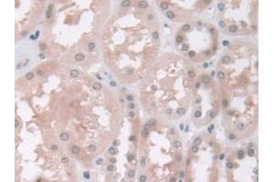 Immunohistochemistry (IHC) image for anti-Guanidinoacetate N-Methyltransferase (GAMT) (AA 64-236) antibody (ABIN7444169)