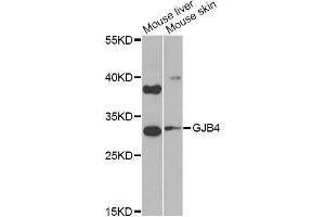 Western blot analysis of extracts of various cell lines, using GJB4 Antibody (ABIN6003620) at 1/1000 dilution. (GJB4 抗体)