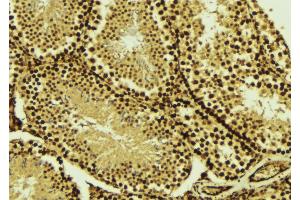 ABIN6269020 at 1/100 staining Mouse testis tissue by IHC-P. (TBP 抗体  (N-Term))