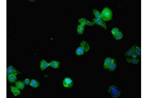 Immunofluorescent analysis of HepG2 cells using ABIN7170849 at dilution of 1:100 and Alexa Fluor 488-congugated AffiniPure Goat Anti-Rabbit IgG(H+L)