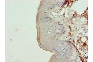 Immunohistochemistry of paraffin-embedded human skin tissue using ABIN7157364 at dilution of 1:100 (Keratin 35 抗体  (AA 1-455))