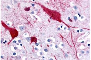 Human Brain, Cortex (formalin-fixed, paraffin-embedded) stained with SLC5A9 antibody ABIN213393 at 10 ug/ml followed by biotinylated goat anti-rabbit IgG secondary antibody ABIN481713, alkaline phosphatase-streptavidin and chromogen. (SLC5A9 抗体  (C-Term))