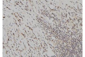 ABIN6261071 and ABIN6277699 at 1/100 staining Human gastric tissue by IHC-P. (CSTA 抗体  (C-Term))