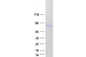 Western Blotting (WB) image for Ectodysplasin A Receptor (EDAR) protein (Myc-DYKDDDDK Tag) (ABIN2719928)