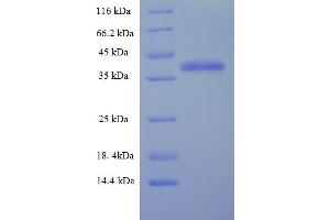 SDS-PAGE (SDS) image for Charged Multivesicular Body Protein 5 (CHMP5) (AA 1-219), (full length) protein (His-SUMO Tag) (ABIN5711871)