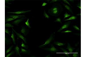Immunofluorescence of purified MaxPab antibody to NLK on HeLa cell. (Nemo-Like Kinase 抗体  (AA 1-515))
