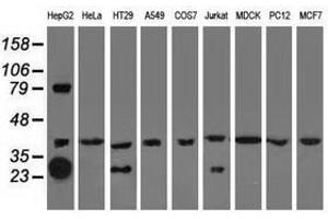 Image no. 1 for anti-Quinolinate Phosphoribosyltransferase (QPRT) antibody (ABIN1500530) (QPRT 抗体)