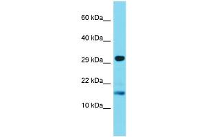 Host: Rabbit Target Name: TREML4 Sample Type: Jurkat Whole Cell lysates Antibody Dilution: 1. (TREML4 抗体  (C-Term))