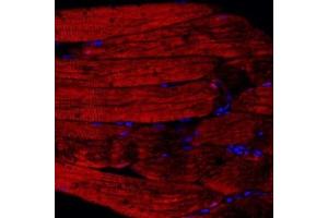 Immunofluorescent analysis of paraffin embedded rat skeletal muscle using PPP2R2C (ABIN7075278) at dilution of 1: 500 (PPP2R2C 抗体)