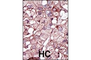 Immunohistochemistry (Paraffin-embedded Sections) (IHC (p)) image for anti-Activin A Receptor Type II-Like 1 (ACVRL1) (AA 38-68), (N-Term) antibody (ABIN392241)