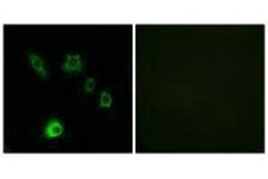 Immunofluorescence analysis of HuvEc cells, using FGF18 antibody. (FGF18 抗体)
