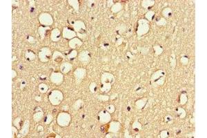 Immunohistochemistry of paraffin-embedded human brain tissue using ABIN7166372 at dilution of 1:100 (ZNF365 抗体  (AA 241-401))