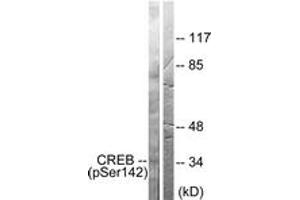 Western blot analysis of extracts from HeLa cells treated with PMA 125ng/ml 30', using CREB (Phospho-Ser142) Antibody. (CREB1 抗体  (pSer142))