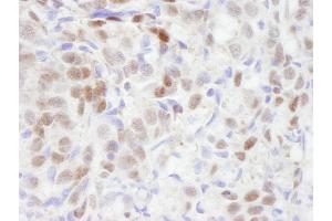 Immunohistochemistry (IHC) image for anti-Transducin (Beta)-Like 1 X-Linked Receptor 1 (TBL1XR1) (AA 100-150) antibody (ABIN7448826) (TBL1XR1 抗体  (AA 100-150))